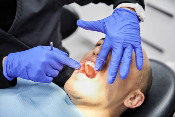 Best Teeth Whitening  in Reamstown, PA
